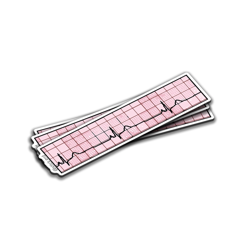[I1A-6] Electrocardiograma Ritmo